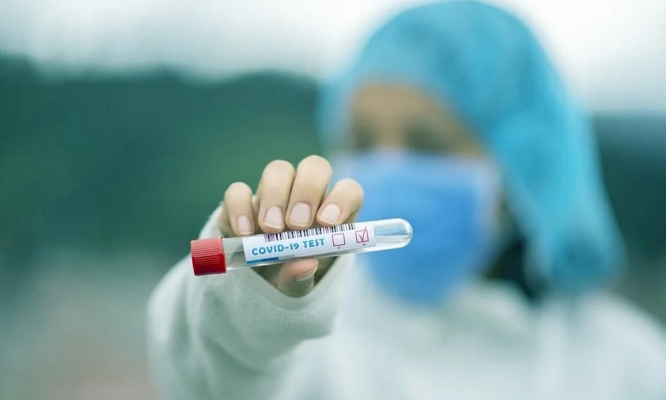 15 новых случаев заражения коронавирусом выявили в Удмуртии за минувшие сутки
