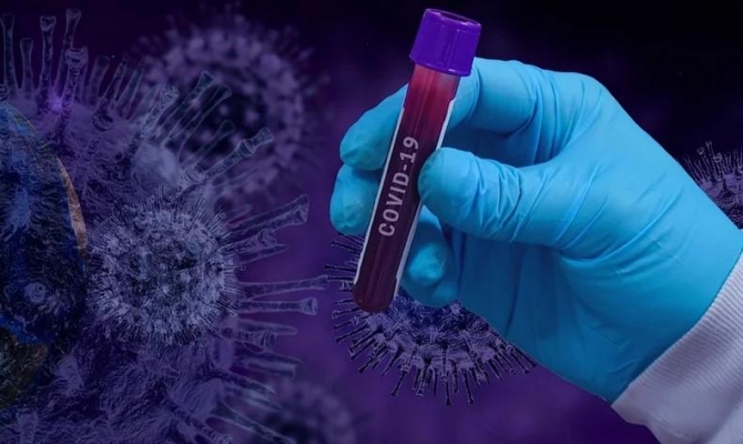 16 новых случаев заражения коронавирусом подтвердились в Удмуртии