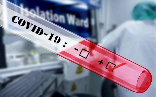 11 новых случаев заражения коронавирусной инфекцией выявили в Удмуртии за минувшие сутки