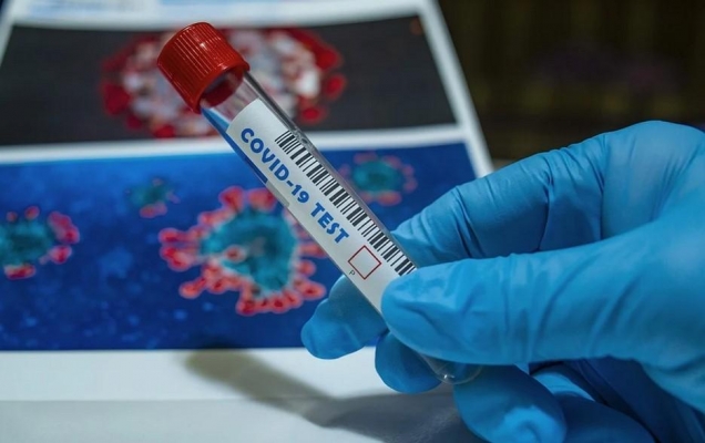 В Минздраве Удмуртии объяснили уровень смертности больных коронавирусом в регионе