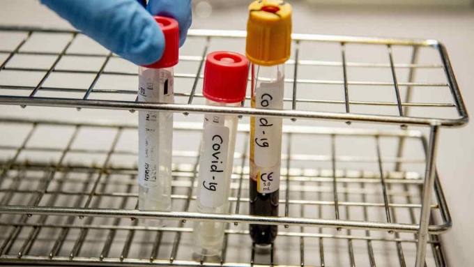 30 новых случаев заражения коронавирусом выявили в Удмуртии за минувшие сутки