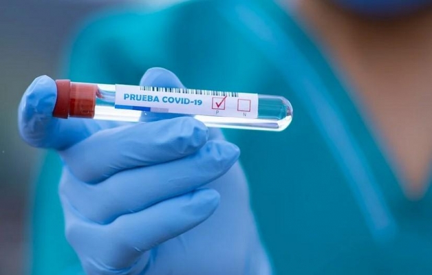 22 новых случая заражения коронавирусом выявили в Удмуртии за сутки