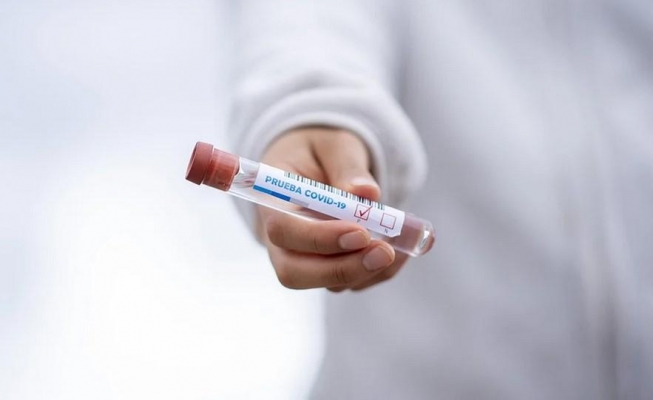 6 новых случаев заражения коронавирусной инфекцией выявили в Удмуртии за сутки