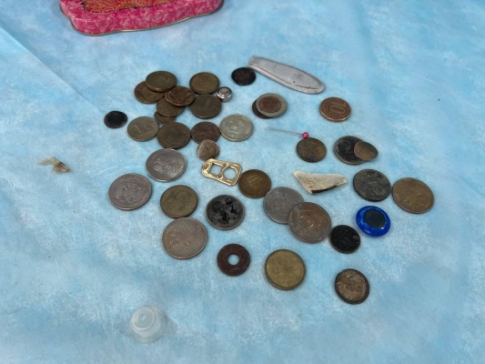 Шкатулка с монетами из желудков детей хранится в Глазовской больнице
