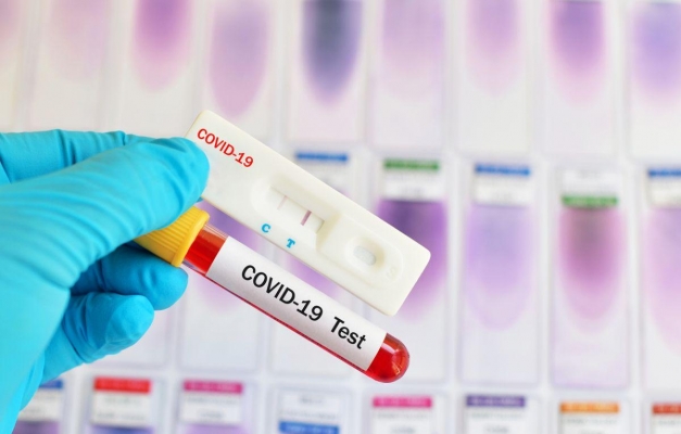 Показатель заболеваемости COVID-19 на 100 тысяч жителей в Удмуртии составляет 447 