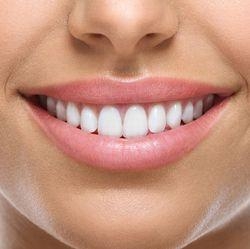 Имплантация зубов — положительные характеристики