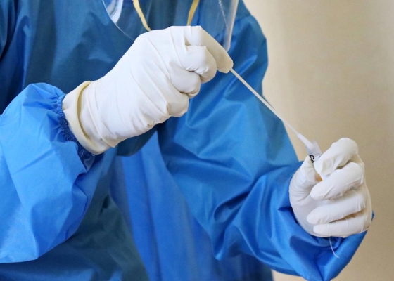 В Удмуртии выявили первых заболевших штаммом коронавируса «омикрон»