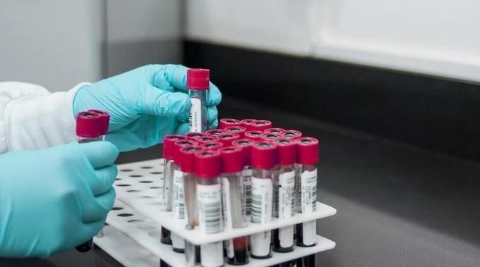 9 новых случаев заражения коронавирусом подтвердились в Удмуртии