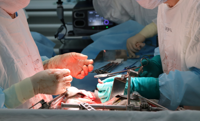 Онкологи Удмуртии успешно провели сложную операцию по удалению опухоли пищевода