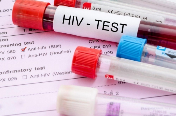 В Удмуртии с начала года 227 пациентам поставили диагноз «ВИЧ»